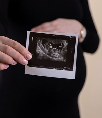 Woman holding ultrasound unsplash