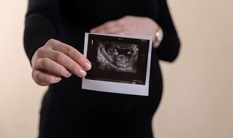 Woman holding ultrasound unsplash