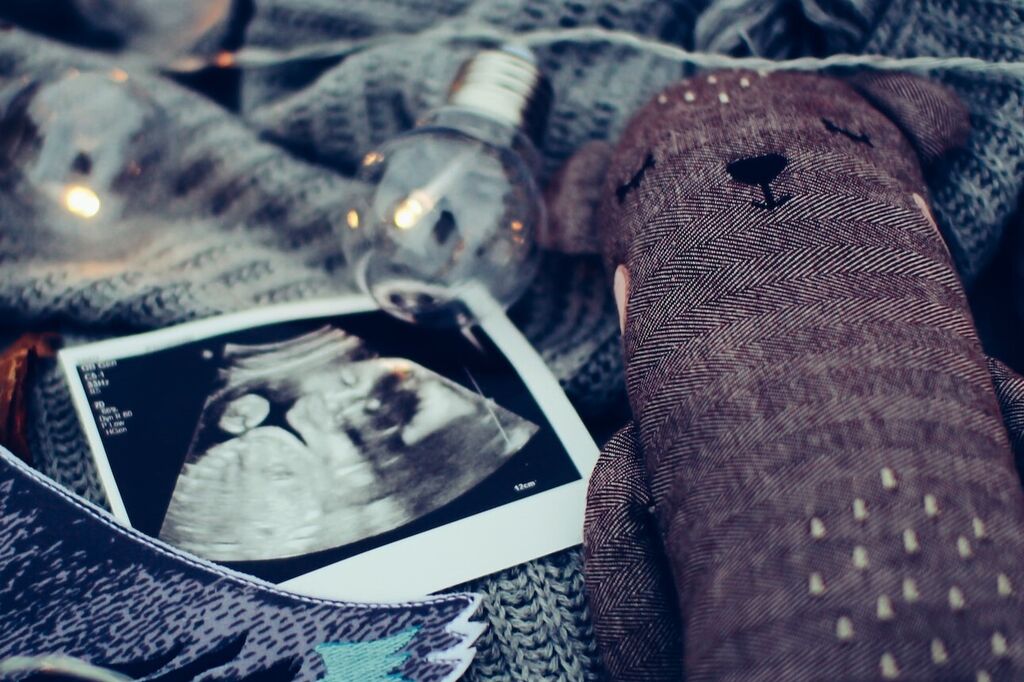 Baby scan daiga ellaby ND8movh PDLY unsplash