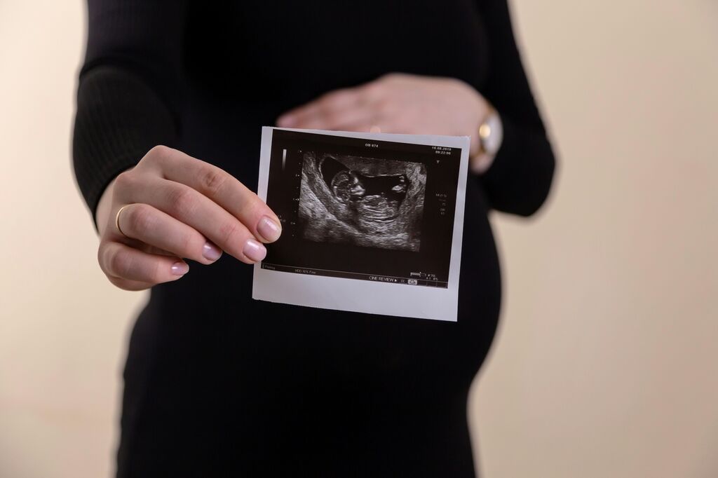 Pregnant pregnancy scan picture